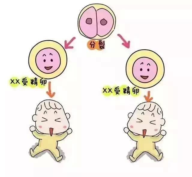 男性不育症