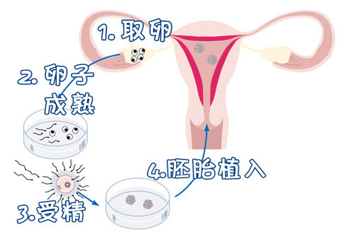 男性孕前检查