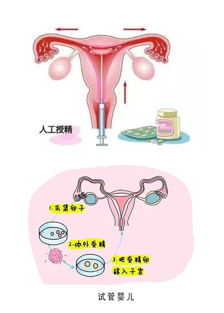 男性备孕