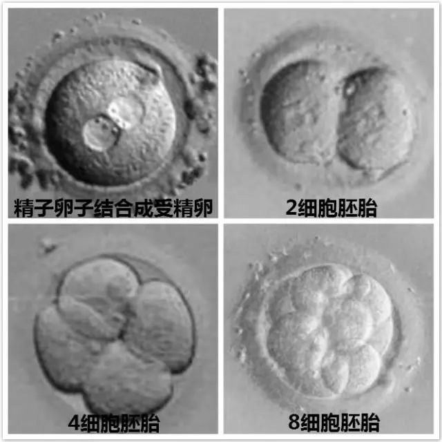 男性不孕不育