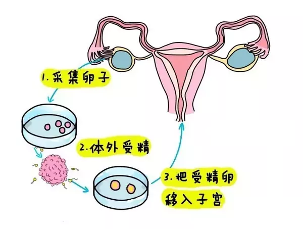 男性不育