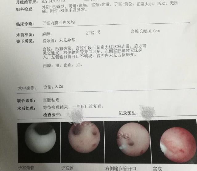 男性不孕不育