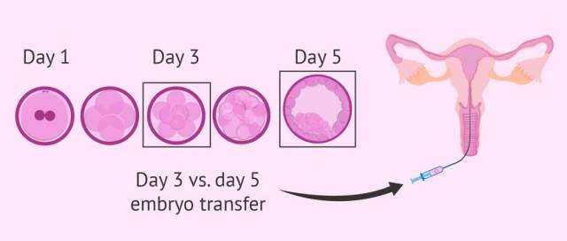 男性孕前检查