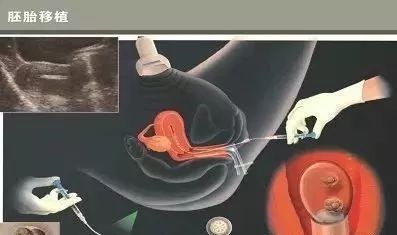 男性不怀孕怎么办