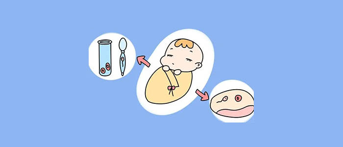 男方孕前检查