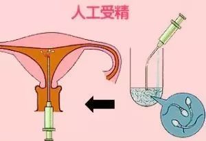 胚胎移植
