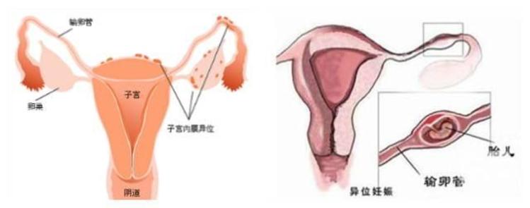移植囊胚