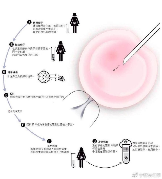 移植囊胚