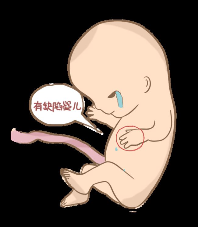 器官移植