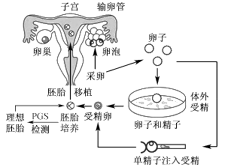 胚胎移植