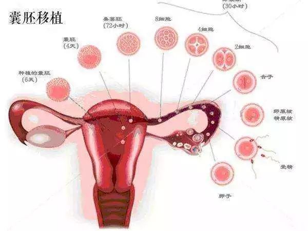 试管移植