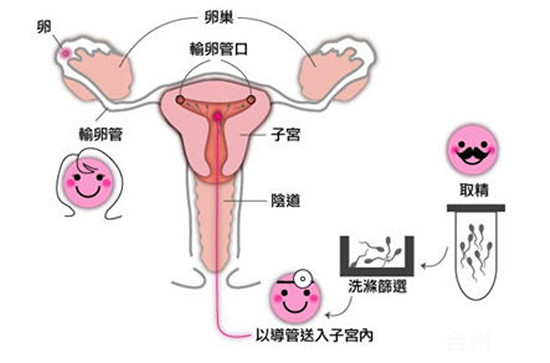 移植囊胚
