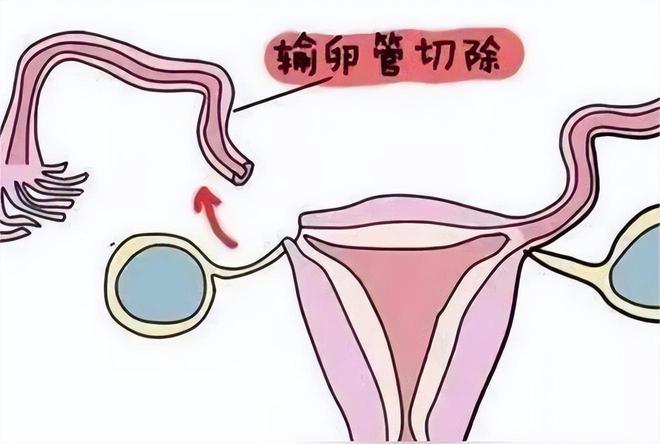夫妻离婚