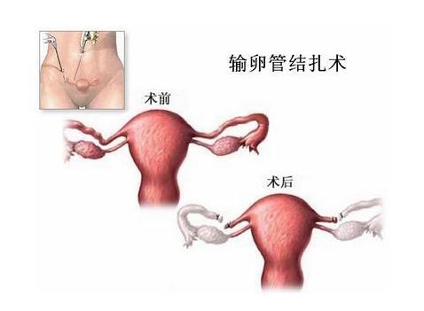 夫妻离婚
