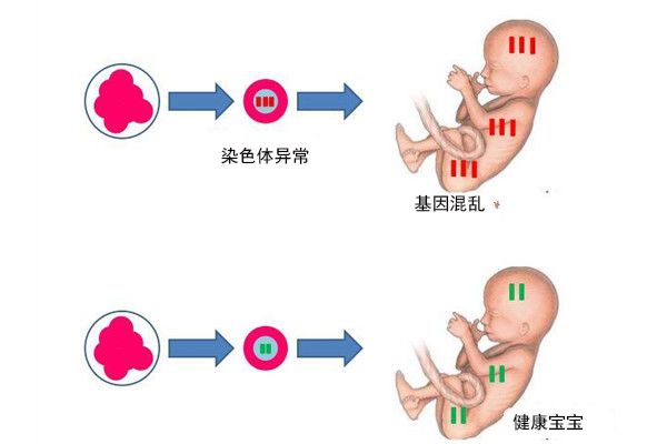 胚胎移植