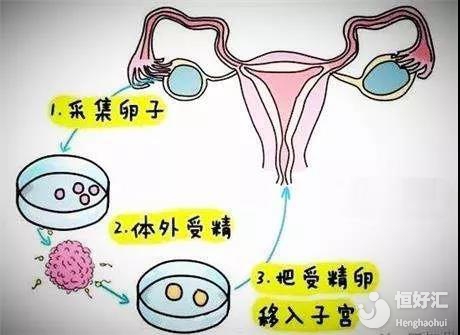 夫妻离婚